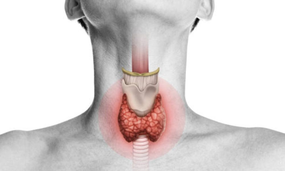 Hypothyroidism (Underactive Thyroid).jpg