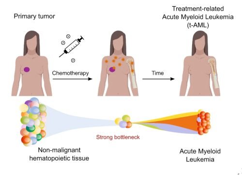 cancer treatment in Agra cancer treatment in Agra