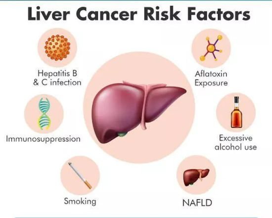 Risk Factors of Liver Cancer Risk Factors of Liver Cancer