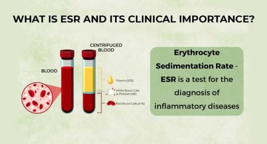 high esr levels high esr levels