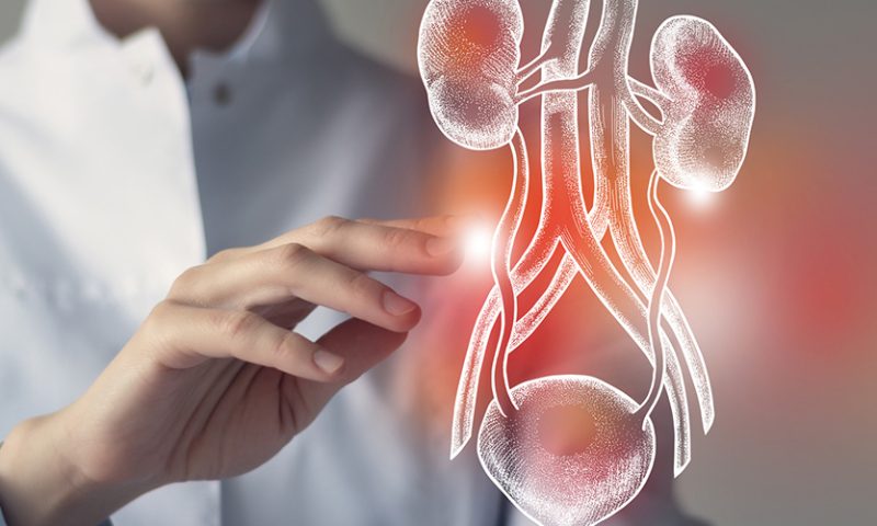 bladder cancer