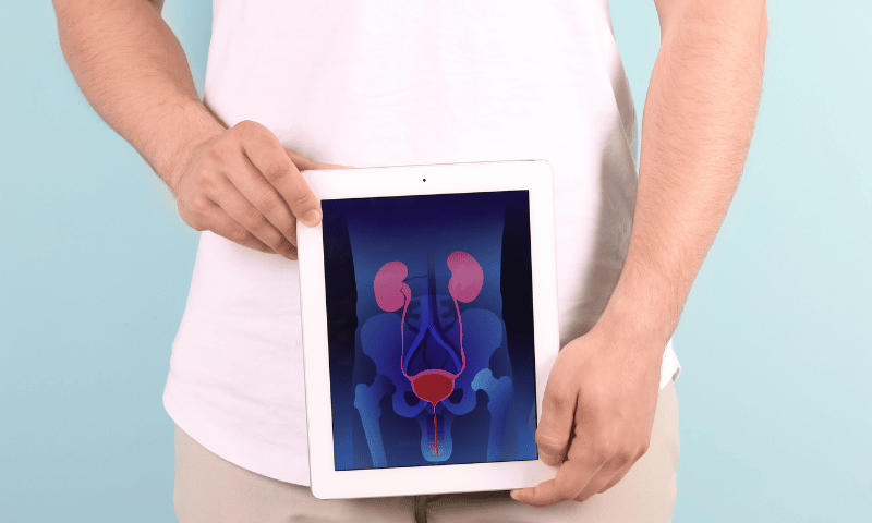 Prostate Cancer